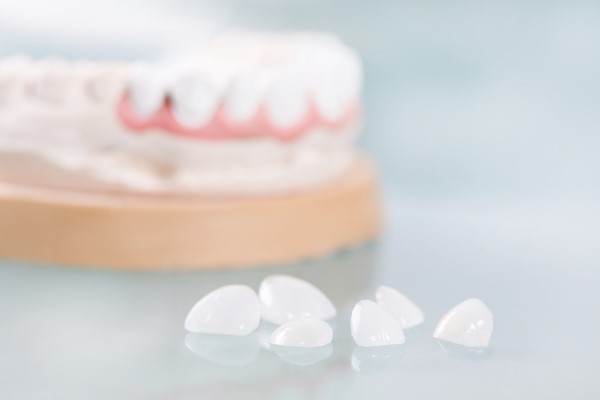 An Easy Guide To Caring For Your New Dental Veneers