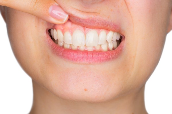 Can Gum Disease Be Treated At Home?